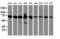 Serine Peptidase Inhibitor, Kunitz Type 1 antibody, M04685, Boster Biological Technology, Western Blot image 