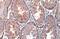 Androgen Receptor antibody, GTX635842, GeneTex, Immunohistochemistry paraffin image 