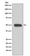 Keratin 13 antibody, M04299, Boster Biological Technology, Western Blot image 