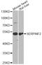 Serpin Family F Member 2 antibody, LS-C749059, Lifespan Biosciences, Western Blot image 