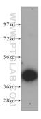 Secretory Carrier Membrane Protein 2 antibody, 15119-1-AP, Proteintech Group, Western Blot image 