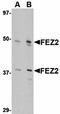 Interleukin 17 Receptor B antibody, orb5537, Biorbyt, Western Blot image 