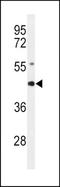 RAGE antibody, TA324792, Origene, Western Blot image 