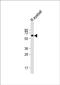 Keratin 12 antibody, PA5-71744, Invitrogen Antibodies, Western Blot image 