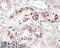 Alpha-1-antitrypsin antibody, 43-459, ProSci, Enzyme Linked Immunosorbent Assay image 