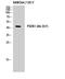 Presenilin 1 antibody, STJ95221, St John