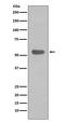 Keratin 4 antibody, M07410, Boster Biological Technology, Western Blot image 