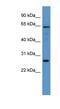 Flavin Containing Dimethylaniline Monoxygenase 4 antibody, NBP1-69026, Novus Biologicals, Western Blot image 