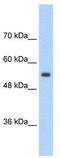 Solute Carrier Family 13 Member 3 antibody, TA346061, Origene, Western Blot image 