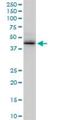 Zinc Finger RANBP2-Type Containing 2 antibody, H00009406-M02, Novus Biologicals, Western Blot image 