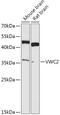 Von Willebrand Factor C Domain Containing 2 antibody, 18-133, ProSci, Western Blot image 