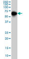 SMAD Family Member 4 antibody, LS-C197636, Lifespan Biosciences, Western Blot image 