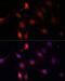 Gastrulation Brain Homeobox 2 antibody, LS-C749716, Lifespan Biosciences, Immunofluorescence image 