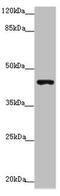 Purinergic Receptor P2X 3 antibody, LS-C676215, Lifespan Biosciences, Western Blot image 
