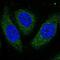 Aspartate Beta-Hydroxylase antibody, NBP2-58045, Novus Biologicals, Immunocytochemistry image 