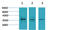 Calcium Voltage-Gated Channel Auxiliary Subunit Gamma 2 antibody, STJ97416, St John