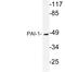 Serpin Family E Member 1 antibody, LS-C291727, Lifespan Biosciences, Western Blot image 