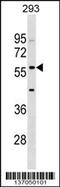 Interferon Induced Protein With Tetratricopeptide Repeats 2 antibody, 58-948, ProSci, Western Blot image 