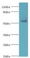 Poly(ADP-Ribose) Polymerase Family Member 3 antibody, LS-C376270, Lifespan Biosciences, Western Blot image 