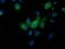 Mahogunin Ring Finger 1 antibody, MA5-25496, Invitrogen Antibodies, Immunocytochemistry image 