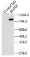 Procollagen-Lysine,2-Oxoglutarate 5-Dioxygenase 3 antibody, FNab06554, FineTest, Immunoprecipitation image 