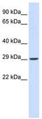 Vesicle Transport Through Interaction With T-SNAREs 1A antibody, TA340393, Origene, Western Blot image 