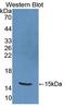 CAMP-Dependent Protein Kinase Inhibitor Beta antibody, LS-C373937, Lifespan Biosciences, Western Blot image 