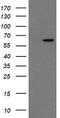 Chaperonin Containing TCP1 Subunit 8 Like 2 antibody, TA505304, Origene, Western Blot image 