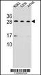 CD79a antibody, 56-825, ProSci, Western Blot image 