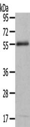 Ectonucleotide Pyrophosphatase/Phosphodiesterase 7 antibody, CSB-PA117174, Cusabio, Western Blot image 