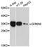 Gem Nuclear Organelle Associated Protein 8 antibody, LS-C748743, Lifespan Biosciences, Western Blot image 