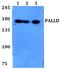 Palladin, Cytoskeletal Associated Protein antibody, A04005, Boster Biological Technology, Western Blot image 