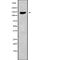 Cytoplasmic Linker Associated Protein 2 antibody, abx149365, Abbexa, Western Blot image 