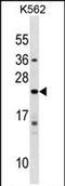 Interferon Alpha 10 antibody, PA5-72006, Invitrogen Antibodies, Western Blot image 