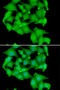 Protein Kinase D3 antibody, STJ29164, St John