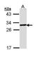 Glutamate-Cysteine Ligase Modifier Subunit antibody, PA5-29384, Invitrogen Antibodies, Western Blot image 