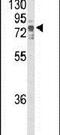 Non-receptor tyrosine-protein kinase TNK1 antibody, PA5-25990, Invitrogen Antibodies, Western Blot image 