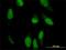 Peripherin antibody, H00005630-M02, Novus Biologicals, Immunocytochemistry image 