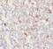 Integrin Subunit Alpha E antibody, FNab09901, FineTest, Immunohistochemistry frozen image 