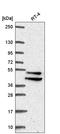 IKBKB Interacting Protein antibody, HPA061541, Atlas Antibodies, Western Blot image 