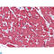 Myosin Light Chain 3 antibody, LS-C814056, Lifespan Biosciences, Immunohistochemistry paraffin image 