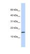 Putative uncharacterized protein encoded by NCRNA00114 antibody, NBP1-70648, Novus Biologicals, Western Blot image 