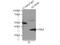 Aldolase, Fructose-Bisphosphate B antibody, 18065-1-AP, Proteintech Group, Immunoprecipitation image 