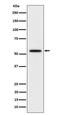 Katanin Catalytic Subunit A1 antibody, M09752, Boster Biological Technology, Western Blot image 