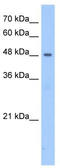 Patatin Like Phospholipase Domain Containing 5 antibody, TA329579, Origene, Western Blot image 