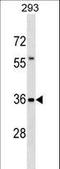 Trafficking From ER To Golgi Regulator antibody, LS-C157177, Lifespan Biosciences, Western Blot image 