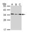 Solute Carrier Family 25 Member 22 antibody, PA5-29181, Invitrogen Antibodies, Western Blot image 