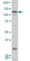 Homeodomain Interacting Protein Kinase 2 antibody, H00028996-M03, Novus Biologicals, Western Blot image 