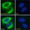 Anti-Mullerian Hormone Receptor Type 2 antibody, 43-644, ProSci, Western Blot image 