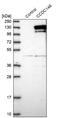 Coiled-Coil Domain Containing 146 antibody, NBP1-86432, Novus Biologicals, Western Blot image 